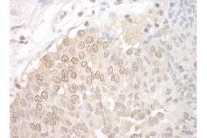 Immunohistochemistry (IHC) image for anti-Uridine-Cytidine Kinase 1-Like 1 (UCKL1) (AA 50-100) antibody (ABIN7453510)