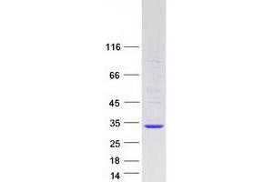 Validation with Western Blot