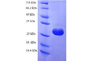 SDS-PAGE (SDS) image for tRNA Methyltransferase 11-2 (TRMT112) (AA 1-125), (full length) protein (His-SUMO Tag) (ABIN5711901)