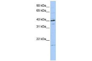 Western Blotting (WB) image for anti-Tubulin Polymerization-Promoting Protein Family Member 3 (TPPP3) antibody (ABIN2458655) (TPPP3 anticorps)