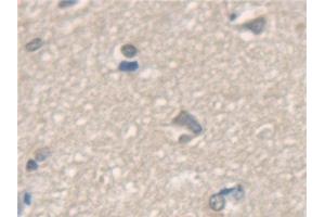 Detection of NSF in Human Cerebrum Tissue using Polyclonal Antibody to N-Ethylmaleimide Sensitive Factor (NSF)