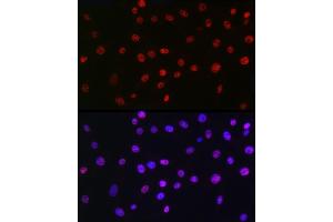 Immunofluorescence analysis of NIH/3T3 cells using QKI Rabbit mAb (ABIN7269699) at dilution of 1:100 (40x lens).