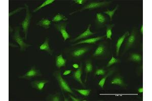 Immunofluorescence of purified MaxPab antibody to ZNF511 on HeLa cell. (ZNF511 anticorps  (AA 1-252))