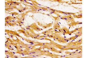 Immunohistochemistry of paraffin-embedded human heart tissue using ABIN7145958 at dilution of 1:100 (CCL15 anticorps  (AA 22-113))