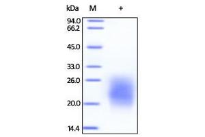 Biotinylated Human GM-CSF on SDS-PAGE under reducing (R) condition. (GM-CSF Protein (AA 18-144) (Biotin))