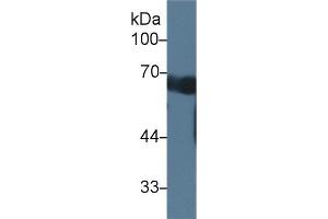 Detection of CCDC60 in Mouse Serum using Polyclonal Antibody to Coiled Coil Domain Containing Protein 60 (CCDC60) (CCDC60 anticorps  (AA 1-186))