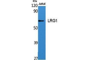 Western Blot (WB) analysis of specific cells using LRG1 Polyclonal Antibody.