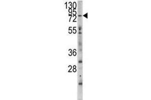 Western blot analysis of MYLK3 antibody and mouse heart tissue lysate