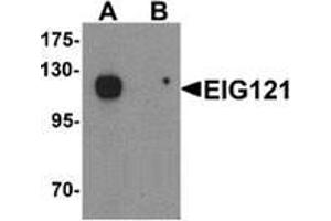 Western blot analysis of EIG121 in MCF7 cell lysate with EIG121 Antibody  at 1 ug/mL in (A) the absence and (B) the presence of blocking peptide. (ELAPOR1 anticorps  (C-Term))