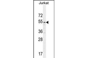 P1 Antibody (Center) (ABIN654665 and ABIN2844361) western blot analysis in Jurkat cell line lysates (35 μg/lane). (MPP1 anticorps  (AA 301-327))