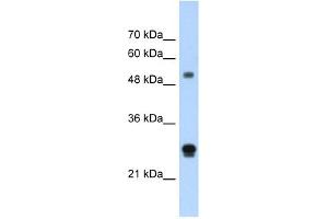 IGSF1 antibody used at 1. (IGSF1 anticorps  (N-Term))
