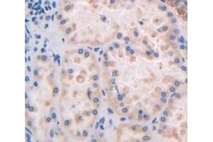 IHC-P analysis of Human Tissue, with DAB staining. (Caspase 2 anticorps  (AA 334-452))