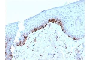 Formalin-fixed, paraffin-embedded human Skin stained with TYRP1-Monospecific Mouse Monoclonal Antibody (TYRP1/3282). (Tyrosinase-Related Protein 1 anticorps  (AA 257-377))