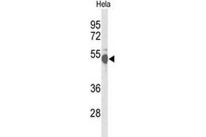 Western blot analysis of CREB3L2 Antibody (C-term) in Hela cell line lysates (35µg/lane). (CREB3L2 anticorps  (C-Term))