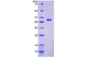 SDS-PAGE analysis of Human ELMO2 Protein. (ELMO2 Protéine)