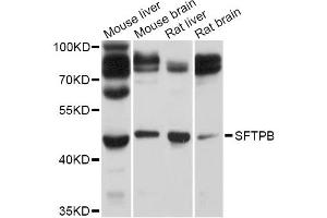 Western blot analysis of extracts of various cell lines, using SFTPB Antibody (ABIN5995955) at 1/1000 dilution. (SFTPB anticorps)