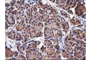 Image no. 5 for anti-Destrin (Actin Depolymerizing Factor) (DSTN) antibody (ABIN1497910) (Destrin anticorps)