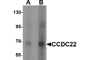 Western blot analysis of CCDC22 in 293 cell lysate with CCDC22 antibody at (A) 1 and (B) 2 µg/mL. (CCDC22 anticorps  (N-Term))