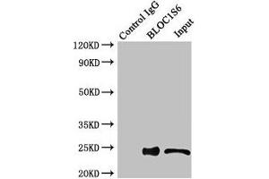 Immunoprecipitating BLOC1S6 in HEK293 whole cell lysate Lane 1: Rabbit control IgG instead of (1 μg) instead of ABIN7145610 in HEK293 whole cell lysate. (Pallidin anticorps  (AA 1-170))