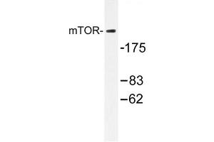 Image no. 1 for anti-Mechanistic Target of Rapamycin (serine/threonine Kinase) (mTOR) antibody (ABIN272127) (MTOR anticorps)