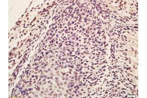 Formalin-fixed and paraffin embedded mouse embryo labeled with Rabbit Anti-Lin28 Polyclonal Antibody, Unconjugated (ABIN1386838) at 1:200 followed by conjugation to the secondary antibody and DAB staining (Lin28A/ B (AA 75-180) anticorps)