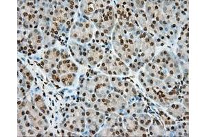 Immunohistochemical staining of paraffin-embedded Human colon tissue using anti-MTRF1L mouse monoclonal antibody. (MTRF1L anticorps)