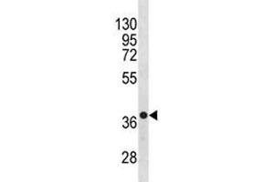 Anti-CXCR4 antibody western blot analysis in NCI-H460 lysate