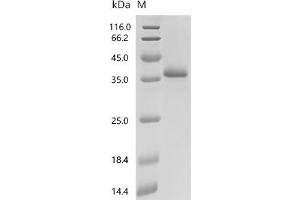 (Tris-Glycine gel) Discontinuous SDS-PAGE (reduced) with 5 % enrichment gel and 15 % separation gel.