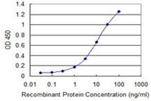 Detection limit for recombinant GST tagged CORO1C is 0.