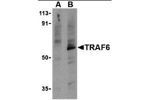 Western Blotting (WB) image for anti-TNF Receptor-Associated Factor 6 (TRAF6) (C-Term) antibody (ABIN1030766)