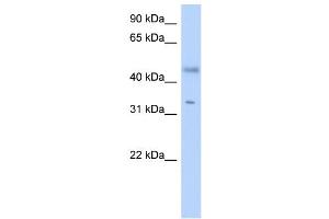 WB Suggested Anti-RDHE2 Antibody Titration: 0. (SDR16C5 anticorps  (Middle Region))