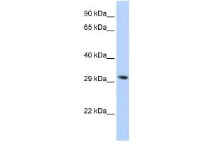 WB Suggested Anti-LYPLA2 Antibody Titration: 0. (LYPLA2 anticorps  (N-Term))