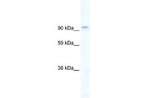 PIK3CB antibody used at 5 ug/ml to detect target protein. (PIK3CB anticorps  (C-Term))