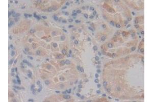 Detection of MAP2K6 in Human Kidney Tissue using Polyclonal Antibody to Mitogen Activated Protein Kinase Kinase 6 (MAP2K6)