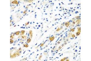 Immunohistochemistry of paraffin-embedded Human stomach using BLVRB Polyclonal Antibody at dilution of 1:100 (40x lens). (BLVRB anticorps)