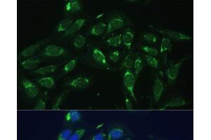Immunofluorescence analysis of U-2 OS cells using COX6A1 Polyclonal Antibody at dilution of 1:100 (40x lens).