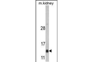 Western blot analysis of DNAJC19 Antibody in mouse kidney tissue lysates (35ug/lane) (DNAJC19 anticorps  (AA 55-84))