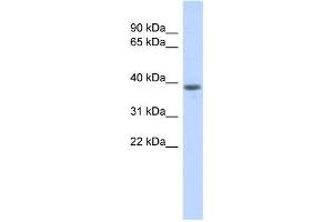 WB Suggested Anti-WDR21B Antibody Titration: 0. (DCAF4L1 anticorps  (Middle Region))