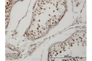 Immunoperoxidase of monoclonal antibody to CRKRS on formalin-fixed paraffin-embedded human testis.