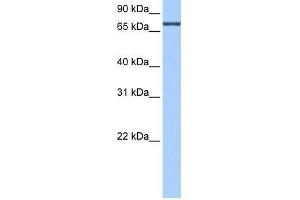 Human HepG2; WB Suggested Anti-ADAD2 Antibody Titration: 0. (ADAD2 anticorps  (C-Term))