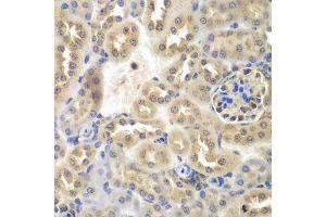 Immunohistochemistry of paraffin-embedded mouse kidney using SULT2B1 antibody.