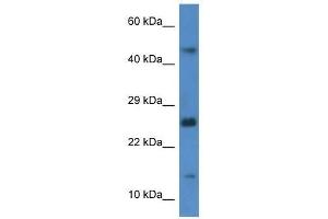 Western Blot showing Gabarapl2 antibody used at a concentration of 1. (GABARAPL2 anticorps  (C-Term))