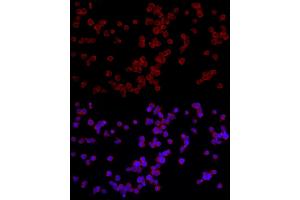 Immunofluorescence analysis of Jurkat cells using NF Rabbit pAb (ABIN6130595, ABIN6144558, ABIN6144559 and ABIN6222368) at dilution of 1:50 (40x lens).