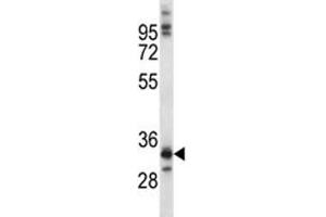 NKX6. (NKX6-1 anticorps  (AA 284-312))