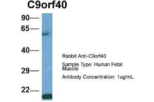 Host: Rabbit  Target Name: C9orf40  Sample Tissue: Human Fetal Muscle  Antibody Dilution: 1. (C9orf40 anticorps  (Middle Region))