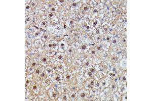 Immunohistochemistry of paraffin-embedded mouse liver using IGHMBP2 antibody (ABIN7267848) at dilution of 1:100 (40x lens).
