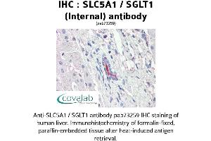 Image no. 2 for anti-Solute Carrier Family 5 (Sodium/glucose Cotransporter), Member 1 (SLC5A1) (Internal Region) antibody (ABIN1739389) (SLC5A1 anticorps  (Internal Region))