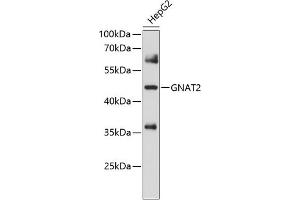Western blot analysis of extracts of HepG2 cells, using GN antibody (ABIN6132936, ABIN6141215, ABIN6141216 and ABIN6214578) at 1:1000 dilution. (GNAT2 anticorps  (AA 1-220))