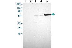 Western blot analysis of Lane 1: Human cell line RT-4, Lane 2: Human cell line U-251MG sp, Lane 3: Human cell line A-431, Lane 4: Human liver tissue, Lane 5: Human tonsil tissue with TYMP polyclonal antibody . (Thymidine Phosphorylase anticorps)