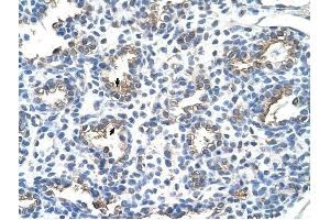 CEACAM6 antibody was used for immunohistochemistry at a concentration of 4-8 ug/ml to stain Alveolar cells (arrows) in Human Lung.